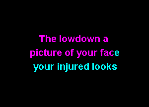 The lowdown a
picture of your face

your injured looks
