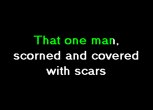 That one man,

scorned and covered
with scars