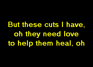 But these cuts l have,

oh they need love
to help them heal, oh