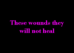 These wounds they

Will not heal