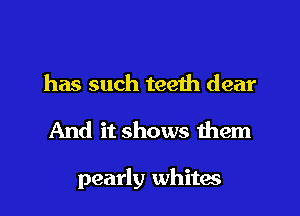 has such teeth dear
And it shows them

pearly whites