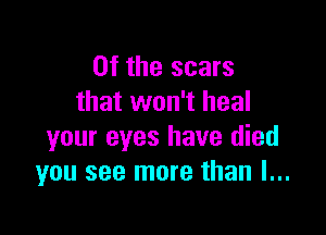 0f the scars
that won't heal

your eyes have died
you see more than I...