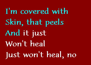 I'm covered with
Skin, that peels

And it just
Won't heal
just won't heal, no