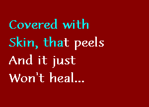 Covered with
Skin, that peels

And it just
Won't heal...