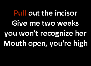 Pull out the incisor
Give me two weeks
you won't recognize her
Mouth open, you're high