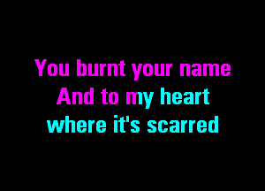 You burnt your name

And to my heart
where it's scarred