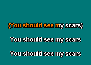 (You should see my scars)

You should see my scars

You should see my scars