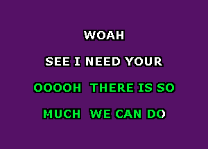 WOAH

SEE I NEED YOUR

OOOOH THERE IS SO

MUCH WE CAN DO