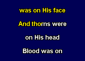 was on His face
And thorns were

on His head

Blood was on