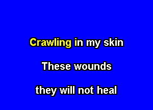 Crawling in my skin

These wounds

they will not heal