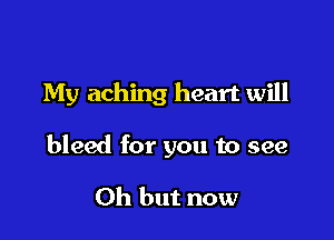 My aching heart will

bleed for you to see

Oh but now
