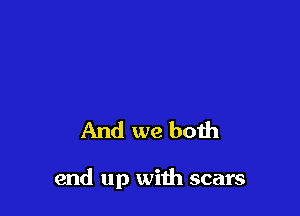 And we both

end up with scars