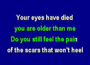Your eyes have died
you are older than me

Do you still feel the pain

of the scars that won't heel