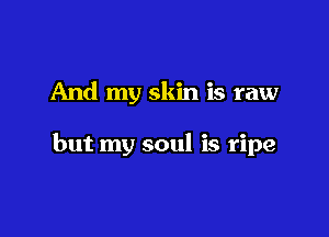 And my skin is raw

but my soul is ripe