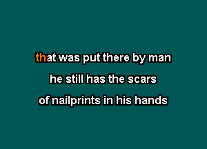 that was put there by man

he still has the scars

of nailprints in his hands
