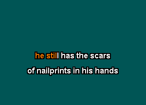he still has the scars

of nailprints in his hands
