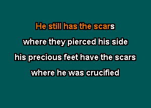 He still has the scars

where they pierced his side

his precious feet have the scars

where he was crucified