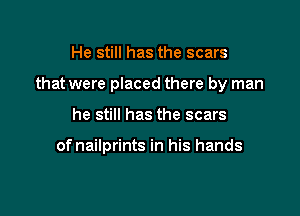 He still has the scars

that were placed there by man

he still has the scars

of nailprints in his hands