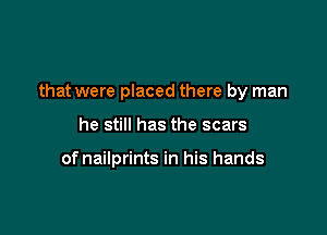 that were placed there by man

he still has the scars

of nailprints in his hands