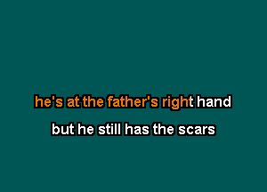 he's at the father's right hand

but he still has the scars