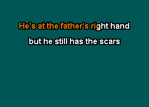 He's at the father's right hand

but he still has the scars