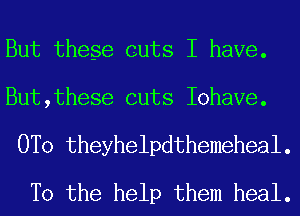 But these cuts I have.

But,these cuts Iohave.

0T0 theyhelpdthemeheal.
T0 the help them heal.