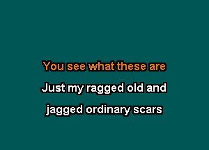 You see what these are

Just my ragged old and

jagged ordinary scars