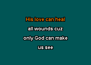 His love can heal

all wounds cuz

only God can make

US see