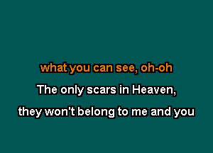 what you can see, oh-oh

The only scars in Heaven,

they won't belong to me and you