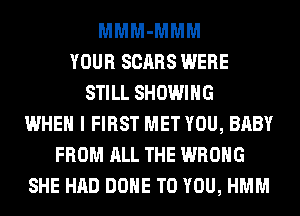 MMM-MMM
YOUR SCARS WERE
STILL SHOWING
WHEN I FIRST MET YOU, BABY
FROM ALL THE WRONG
SHE HAD DONE TO YOU, HMM