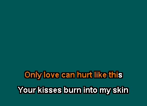 Only love can hurt like this

Your kisses burn into my skin