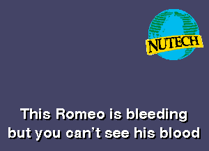 This Romeo is bleeding
but you caWt see his blood