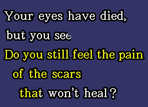 Your eyes have died,

but you see

Do you still feel the pain

of the scars
that won,t heal?