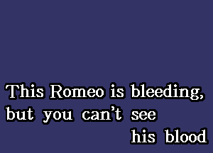 This Romeo is bleeding,

but you cadt see
his blood