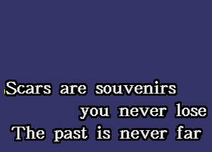 .Scars are souvenirs
you never lose
The past is never far