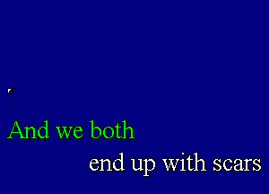 And we both
end up With scars