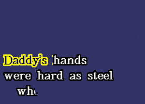 hands

were hard as steel
Why