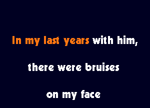 In my last years with him,

there were bruises

on my face