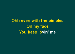 Ohh even with the pimples
On my face

You keep lovin' me