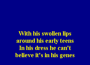 With his swollen lips
around his early teens
In his dress he can't

believe it's in his genes l