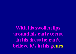 With his swollen lips
around his early teens.
In his dress he can't

believe it's in his genes l