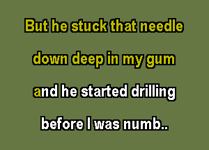 But he stuck that needle

down deep in my gum

and he started drilling

before I was numb..