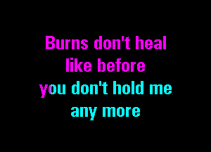 Burns don't heal
like before

you don't hold me
any more
