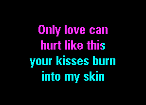 Only love can
hurt like this

your kisses burn
into my skin