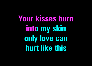 Your kisses burn
into my skin

only love can
hurt like this