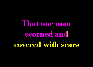 That one man
scorned and
covered with scars

g