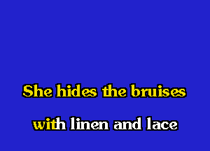 She hides the bruises

with linen and lace