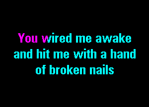 You wired me awake

and hit me with a hand
of broken nails