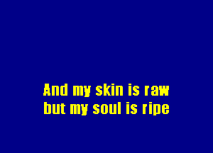 And my skin is raw
but my soul is line