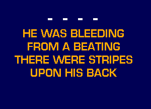 HE WAS BLEEDING
FROM A BEATING
THERE WERE STRIPES
UPON HIS BACK